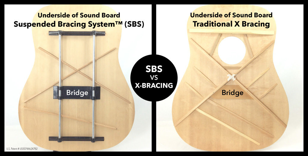 sbs-vs-x-brace-bracing_1024x519-1024x519.jpg